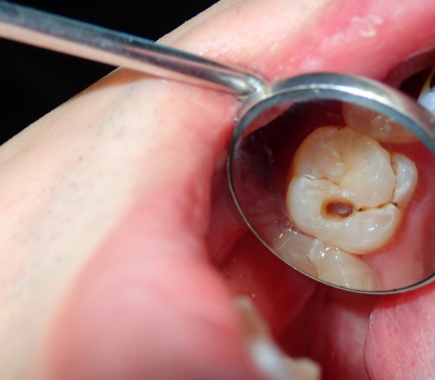 Children's Dentistry