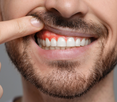 Children's Dentistry