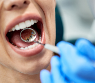 Children's Dentistry