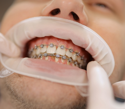 Children's Dentistry