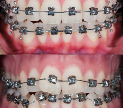 Children's Dentistry