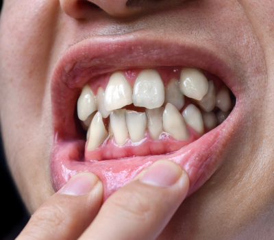 Children's Dentistry