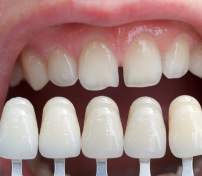 Children's Dentistry